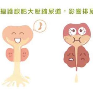 頻尿夜尿老是找不出原因？泌尿科醫師教你用「3天排尿日記」自救，膀胱毛病一秒現形